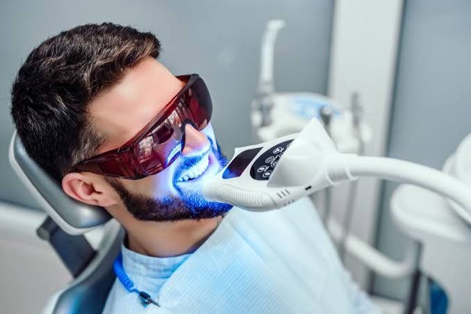 تنظيف وتبييض الأسنان في مركز د. أسامة عامر